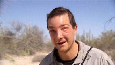 I am not authorised to put the picture of Alejandra’s swollen face on here so here is a picture of Bear Grylls after being stung in the face by a bee. Alejandra looked something like this.